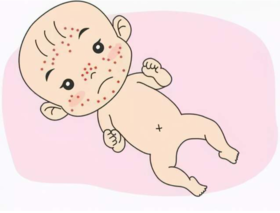 育儿知识-皮肤问题