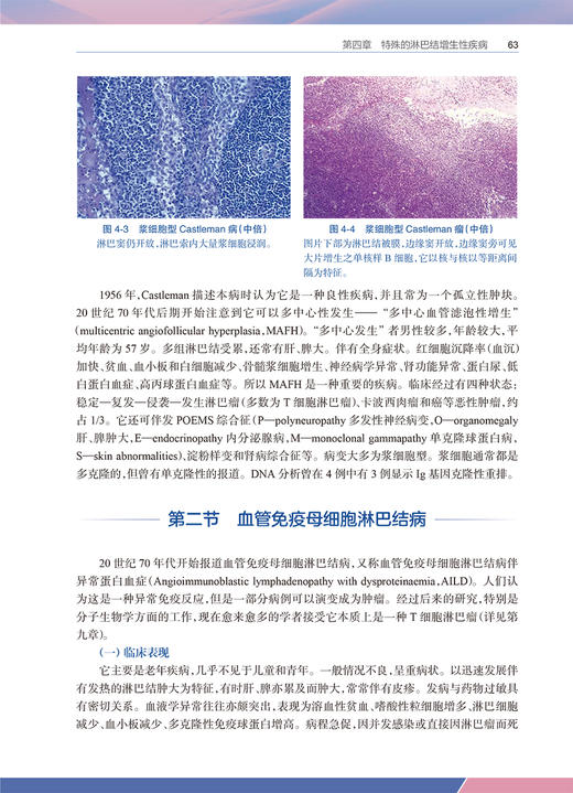 淋巴网状组织病理学 严庆汉 著 淋巴网状组织基本理论知识 淋巴瘤临床病理形态学诊断要点鉴别诊断 人民卫生出版社9787117330411 商品图4