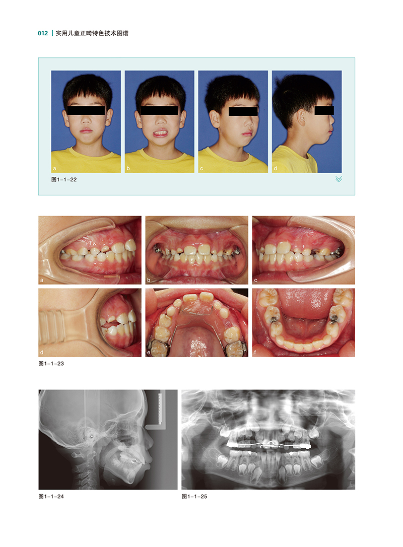 实用儿童正畸特色技术图谱-精彩页-7.jpg