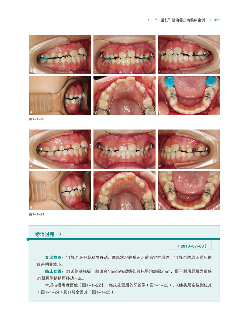 实用儿童正畸特色技术图谱-精彩页-6.jpg
