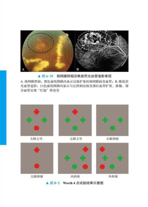儿童眼保健工作实用手册 陈巍 吴夕 张佩斌 编 儿科学眼科学书籍 儿童眼病诊疗眼光配镜视觉康复 中国科学技术出版社9787504688200 商品图3