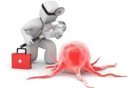  有这些“小毛病”一定要重视，可能癌症已经靠近了 