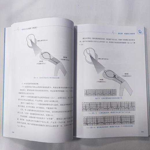 明明白白心电图 第五版第5版 心电图诊断书籍临床心电图图解速成超声基础学入门影像诊断学 广东科技出版社正版书籍9787535979773 商品图4