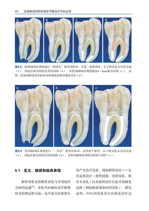 生物陶瓷材料在临床牙髓治疗中的应用 刘贺 喻健主译 亲水性硅酸钙材料临床应用 现代牙髓治疗技术 口腔科学 辽宁科学技术出版社 商品图3