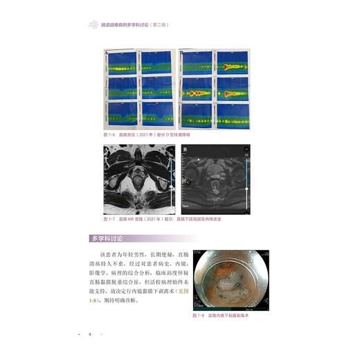 肠道疑难病例多学科讨论（第二辑）/第2辑/临床精析病例集锦/顾于蓓/李玥/梁洁/沈骏/田丰/曹晓沧/浙江大学出版社/病例集/专著 商品图4