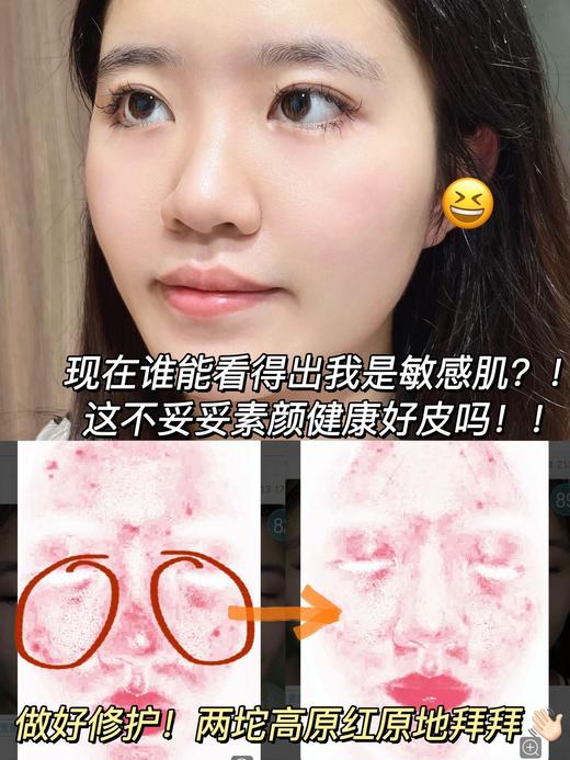 理肤泉特安面膜舒缓修护褪红补水保湿玻尿酸蓝绷带 商品图7