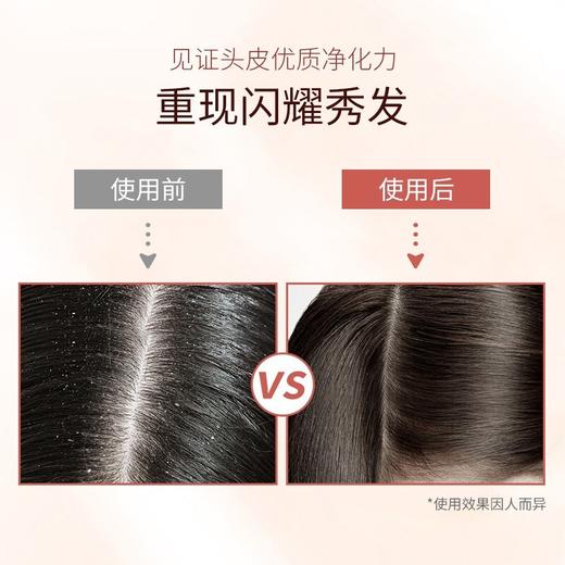 滋源茶籽水润去屑洗头水(中干性)	535ml 商品图4