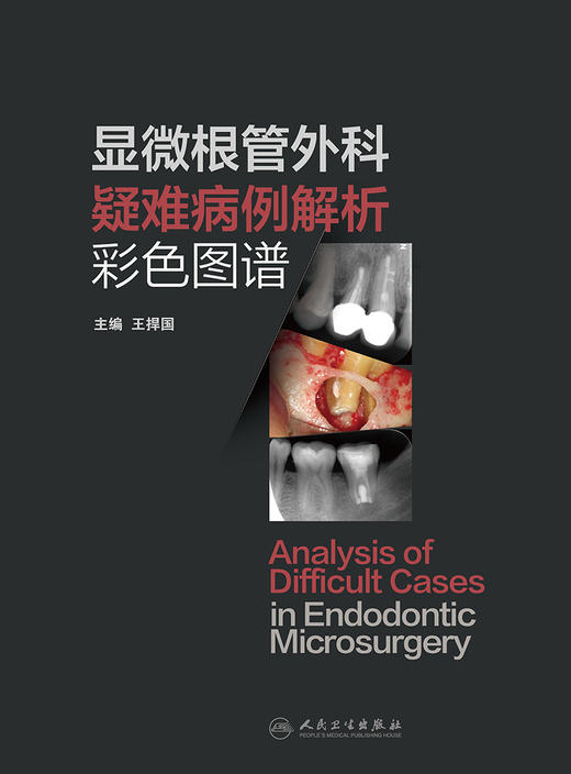显微根管外科疑难病例解析彩色图谱 2023年9月参考书 9787117352062 商品图1