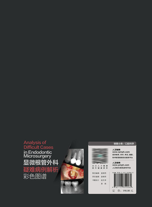 显微根管外科疑难病例解析彩色图谱 2023年9月参考书 9787117352062 商品图2