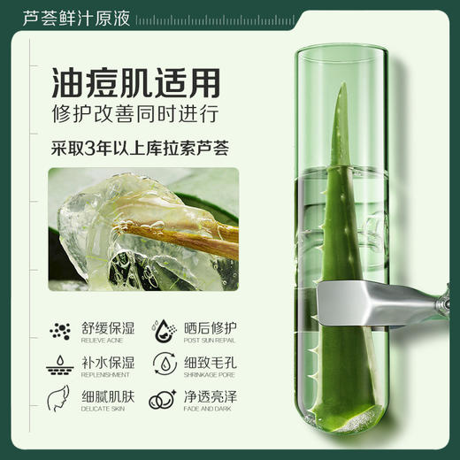 【微信会员专享】瑜然美芦荟水收敛毛孔祛痘保湿补水湿敷水油平衡控油化妆爽肤水护肤品男女 商品图2