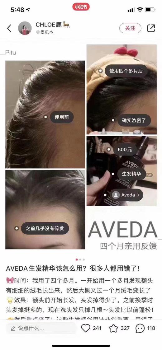 Aveda防tu生发届大佬🐂生发精华头皮焕活精华！ 美国代购，无中文标签，介意慎拍 F 商品图5