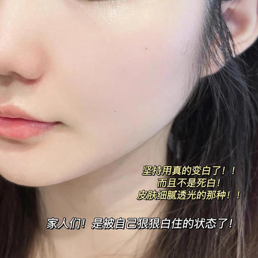 【99任选3件】兰蔻极光乳液净澈焕肤亮白5号乳液15ml小样 保湿美白提亮 商品图9