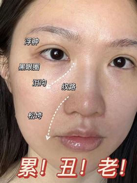 节后如何护肤❓熬夜自救护肤指南速看📝