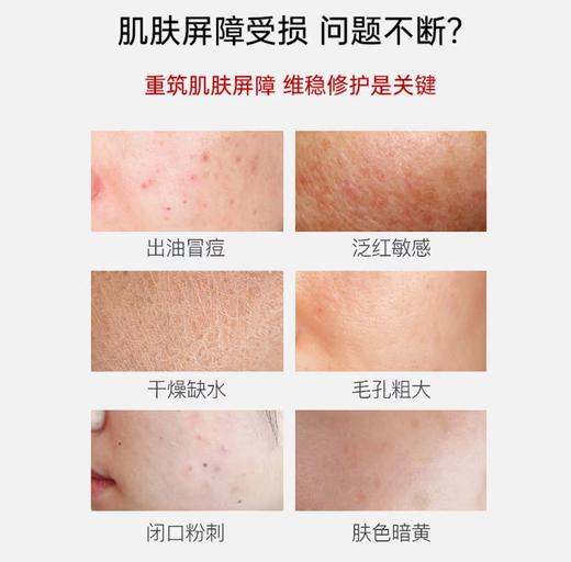 【院线系列】薇诺娜舒敏特护肌底液30ml 敏感肌舒缓补水修护屏障 商品图4