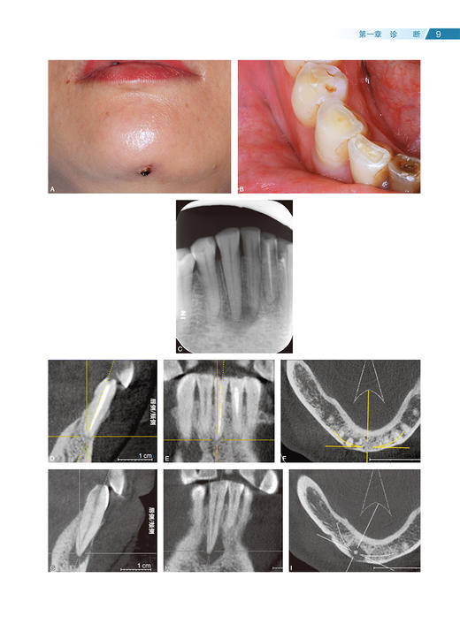 显微根管外科疑难病例解析彩色图谱 王捍国 典型病例解析专家点评 正确诊断治疗方案选择规范化手术操作口腔牙髓病 人民卫生出版社 商品图4