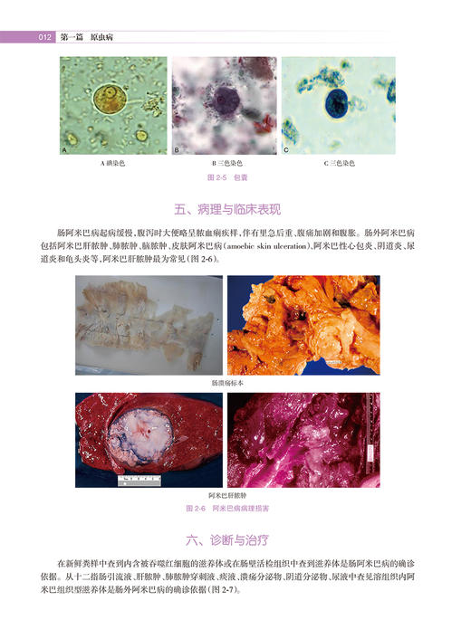 非洲寄生虫病图谱 贾铁武 李石柱 非洲流行寄生虫病地理分布病原学临床表现诊断治疗预防 人民卫生出版社9787117338400 商品图4