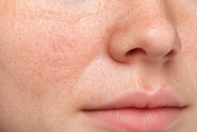 假期过后，你的皮肤还好吗？这款护肤好物了解一下