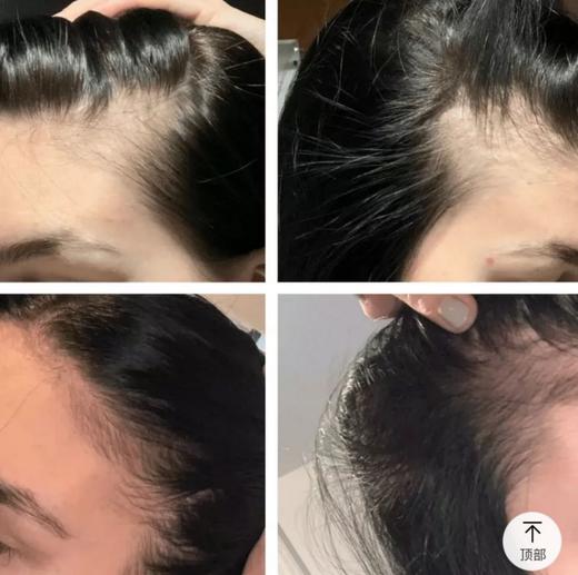 【清仓好价】欧莱雅PRO芯基源蓬松固发精华液小白瓶 90ml 商品图3