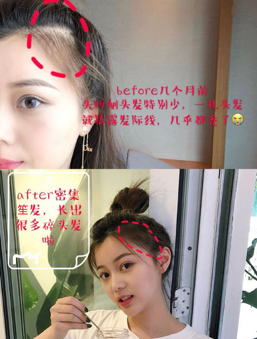 【清仓好价】Aveda艾凡达防脱发生发头皮精华液150ml（效期至24.2） 商品图3