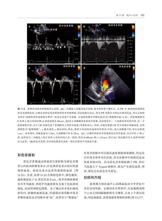 心血管血流动力学指南 第2版 李彤 供临床心脏科医生急诊科及重症科医生进行心血管血流动力学诊断 天津科技翻译出版9787543343047 商品图4