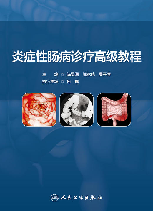 炎症性肠病诊疗高级教程 商品图1
