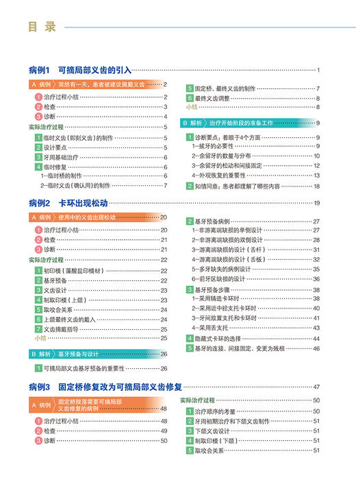 活用可摘局部义齿 从基本操作到灵活运用 和田淳一郎 顾洁 徐晓溪主译 活用可摘局部义齿实际方法 口腔修复 辽宁科学技术出版社 商品图2