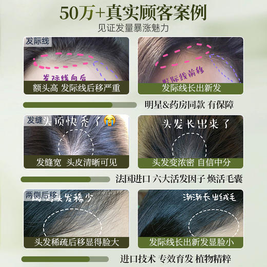 【⚡抢！第2件0元，需拍2件】儒意珠翠丰盈防脱洗发液500g  洗发水 防脱固育发增发密发 | 儒意官方旗舰店 商品图2