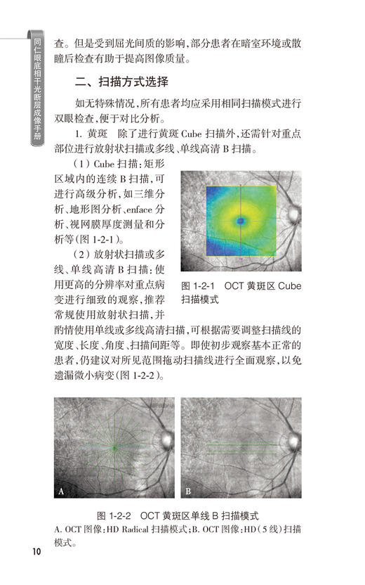 同仁眼底相干光断层成像手册 同仁眼科手册系列 魏文斌 OCT基础知识 图像判读思路正常眼底OCT图像特征 临床常见病 人民卫生出版社 商品图3