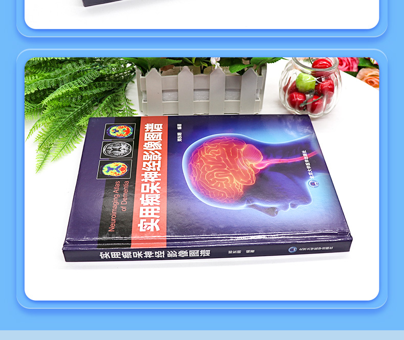 9787565926143-实用痴呆神经影像图谱_05.jpg