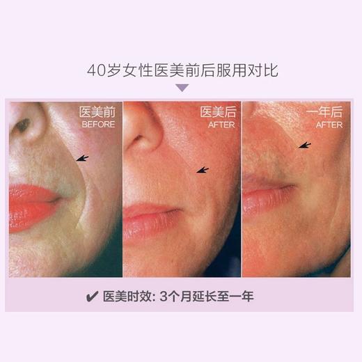 预售10天！高含量3000mg玻尿酸！欧盟医药级！瑞士高分子量和微粉化低分子量透明质酸！极速补水修复骨骼和黏膜！捷克N-Medical加强版透明质酸钠高浓口服玻尿酸50ml  日期27年12月 商品图4