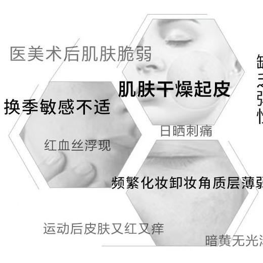 薇诺娜屏障修护保湿水120ml舒缓敏感补水修护面部化妆护肤 商品图5
