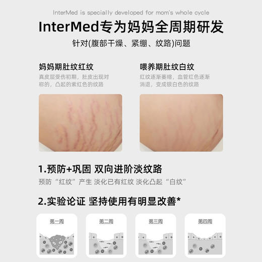 Pregnaderm妊娠纹 商品图2