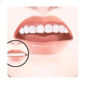 牙齿美白项目！层层焕白，温和甄亮!