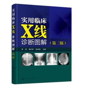 实用临床X线诊断图解 第二版 200多种临床常见病多发病的X线影像表现影像鉴别典型X线影像图片 李泉