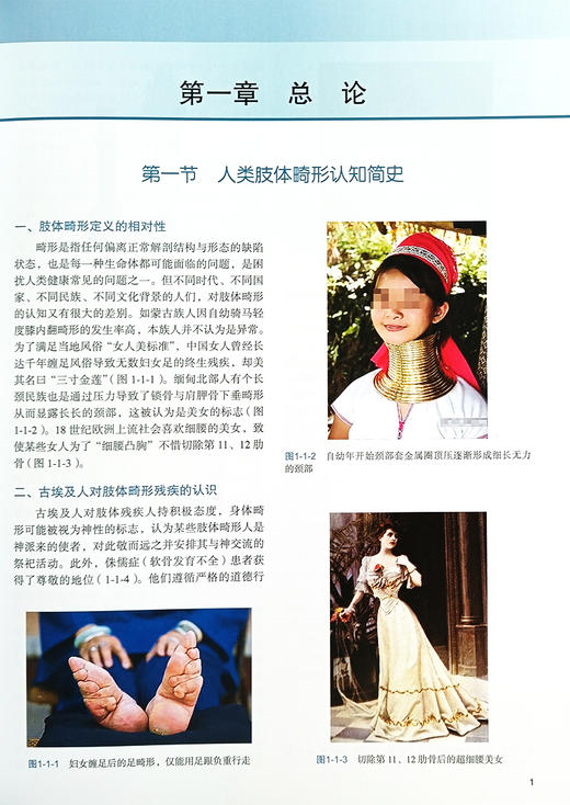 中国肢体畸形病因病种分类 肢体形态与功能重建丛书 上肢下肢形态与功能重建小儿肢体矫形器难治性重建病例精粹 9787565929540 商品图4