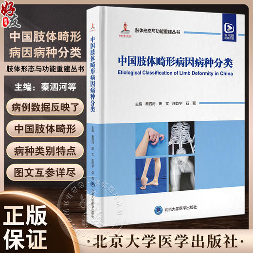 中国肢体畸形病因病种分类 肢体形态与功能重建丛书 上肢下肢形态与功能重建小儿肢体矫形器难治性重建病例精粹 9787565929540 商品图0