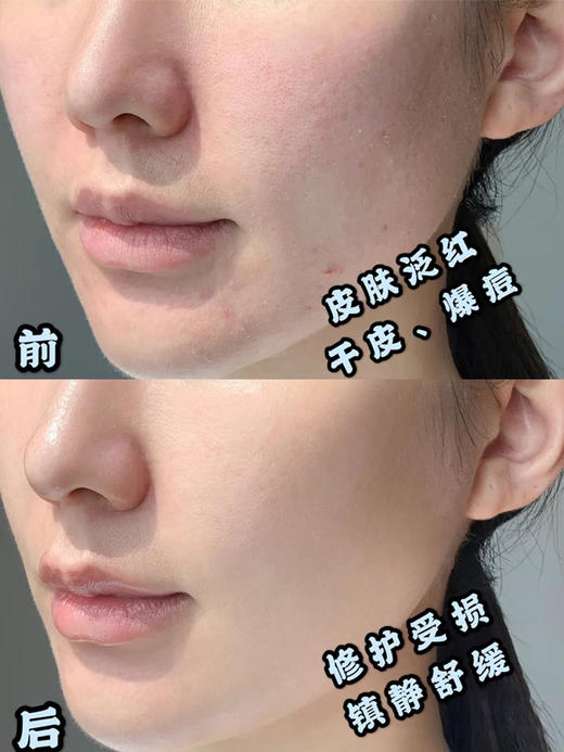 【清仓好价】优色林修红特护日霜/面霜50ml （效期至23.12） 商品图4