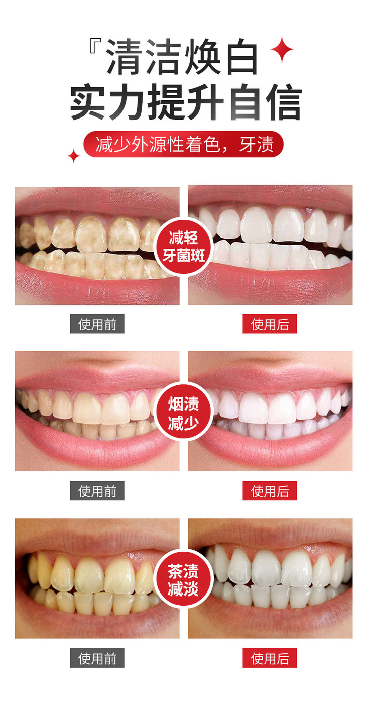 雅牙仕益生菌亮白牙膏_08