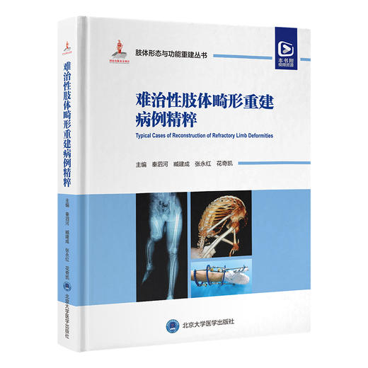 难治性肢体畸形重建病例精粹 肢体形态与功能重建丛书 中国畸形病因病种分类上肢下肢形态与功能重建小儿肢体矫形器 9787565929595 商品图1