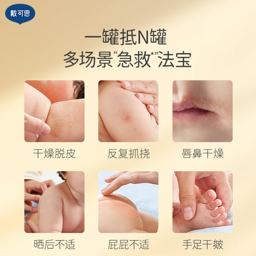 戴可思金盏花膏舒缓修护万用膏儿童应急宝宝润肤乳♥（效期至26年11月） 商品图1