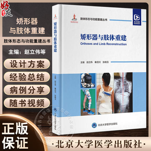 矫形器与肢体重建 肢体形态与功能重建丛书 附视频 中国畸形病因病种上肢下肢形态与功能小儿肢体难治性畸形病例精粹9787565929588 商品图0