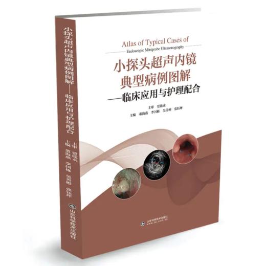 小探头超声内镜典型病例图解——临床应用与护理配合 商品图0