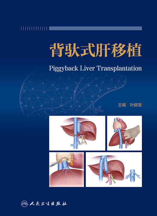 背驮式肝移植 2023年10月参考书 9787117337618 商品图1