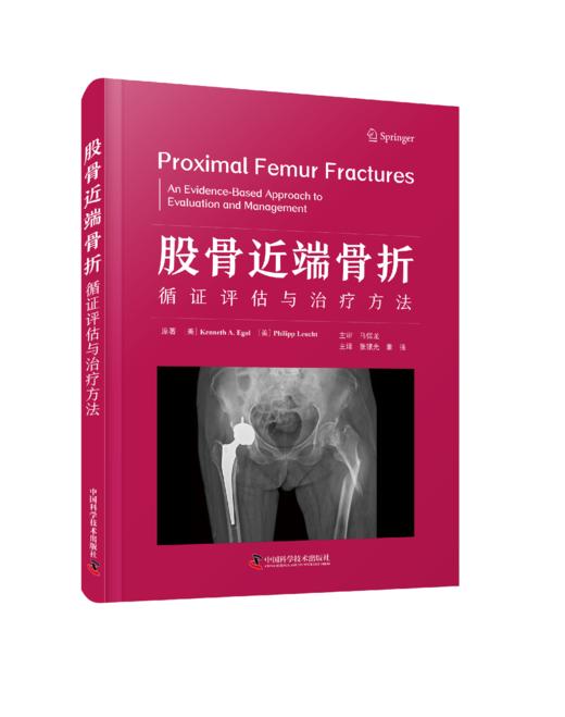 股骨近端骨折：循证评估与治liao方法 商品图0