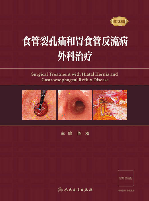 食管裂孔疝和胃食管反流病外科zhi疗 2023年10月参考书 9787117352086 商品图1