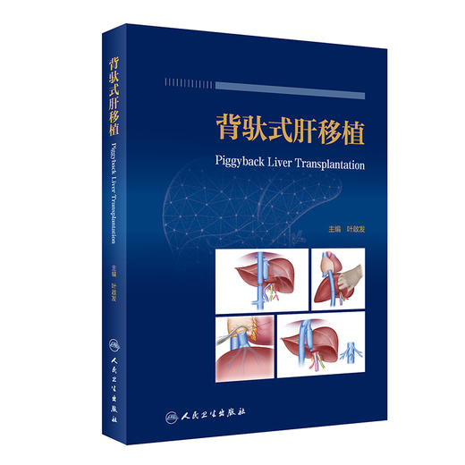 背驮式肝移植 2023年10月参考书 9787117337618 商品图0