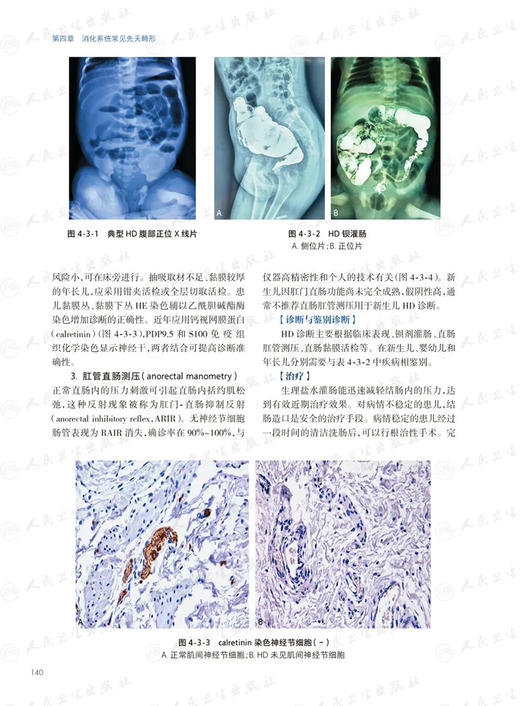 儿童消化病学 附视频 江米足 龚四堂 儿童消化病临床实用诊治思路及经验 胃肠肝病营养微生态等消化领域新进展技术 人民卫生出版社 商品图4