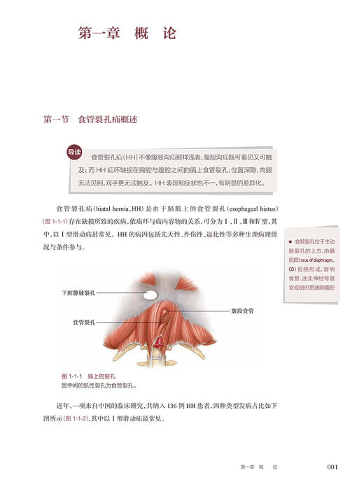 食管裂孔疝和胃食管反流病外科治疗 附手术视频 陈双 疾病手术方法操作步骤及术中相关技巧注意事项 人民卫生出版社9787117352086 商品图3