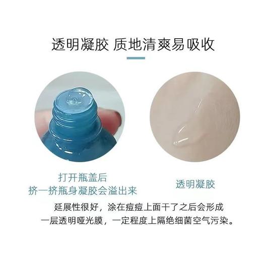 悦木之源净痘祛痘凝胶10ml预防舒缓面部痘印修护肌肤 商品图1