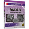 放射学个案综述系列 脑部成像 商品缩略图0